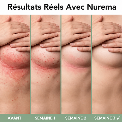 Nurema – Crème apaisante contre l'intertrigo